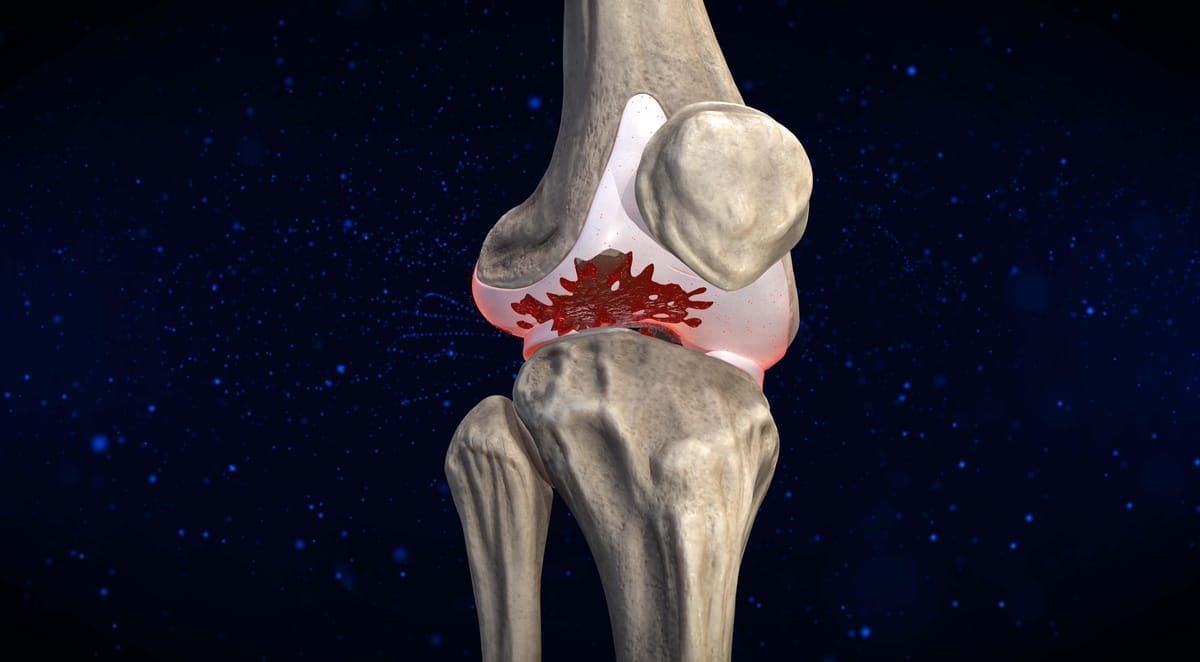 What If You Had Two Days to Back a Breakthrough That Could Change Lives and You Let It Pass?*