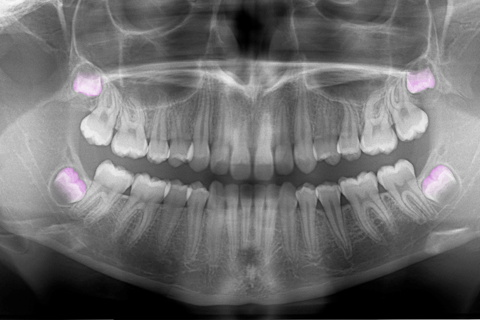 Amazon Is Making a Smartphone Again